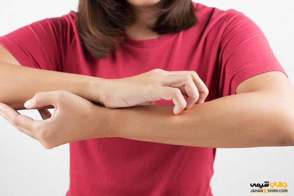 جوش و سوزش پوست بعد از استفاده از نوره؛ واکنش طبیعی یا نشانه پاکسازی؟