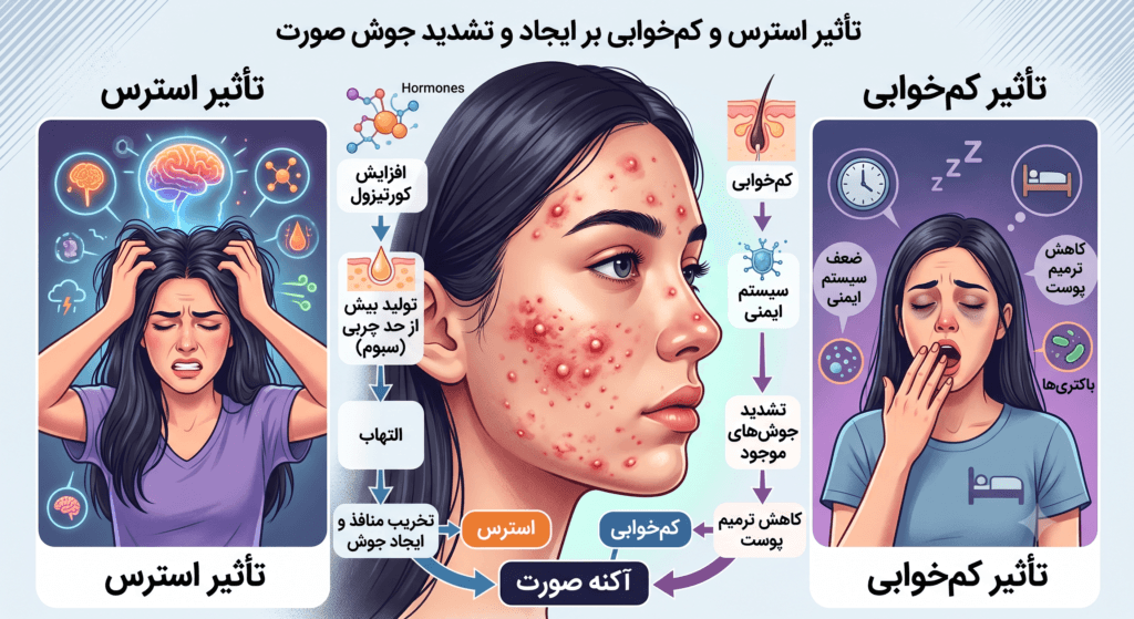 تاثیر استرس و کم خوابی بر آکنه پوست