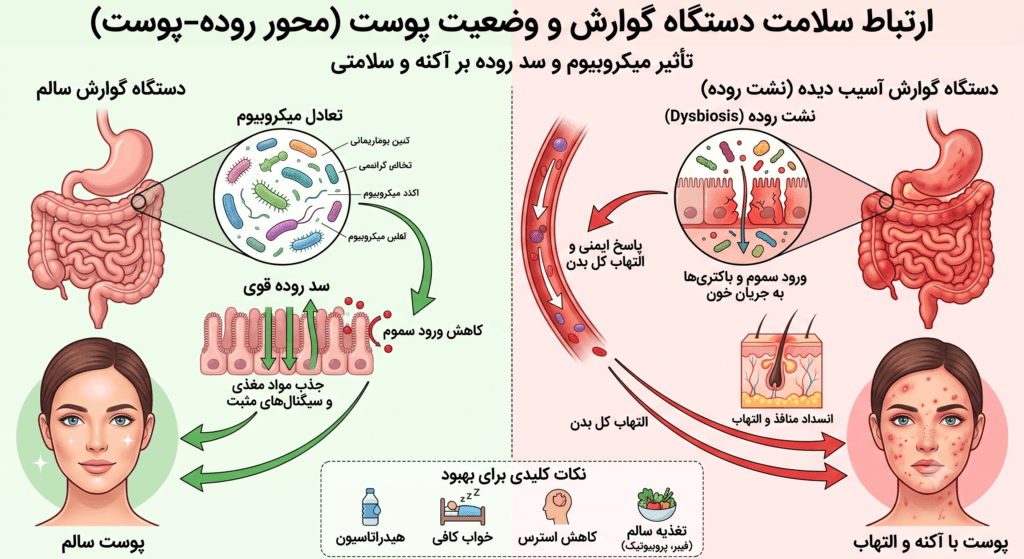 ارتباط سلامت دستگاه گوارش با وضعیت پوست و آکنه